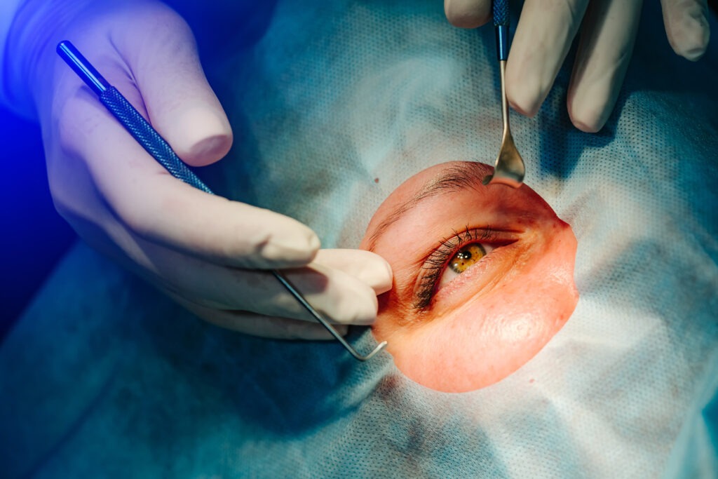 best lasik eye surgery in mumbai - oswal eye care