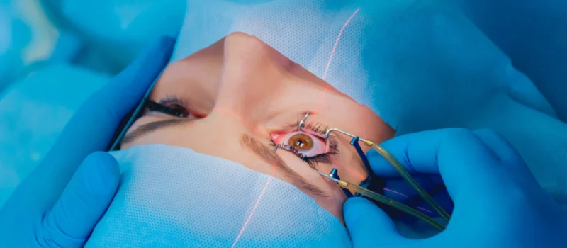 laser-vision-correction-patient-team-surgeons-operating-room-ophthalmic-surgery how is cataract surgery performed - oswal eye care