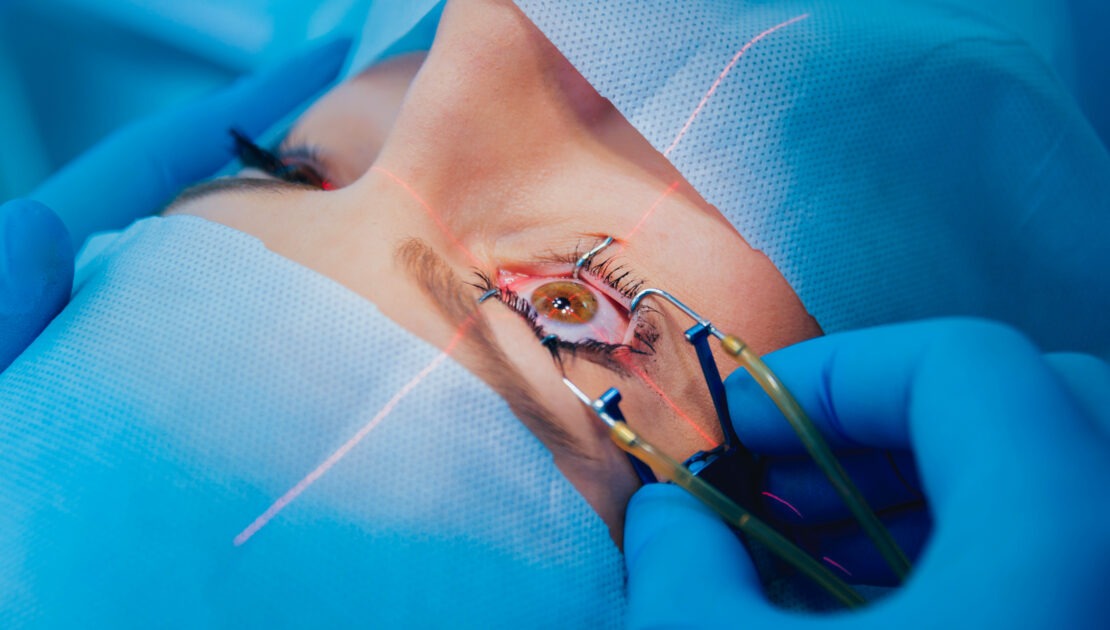 cataract surgery in mumbai - oswal eye care