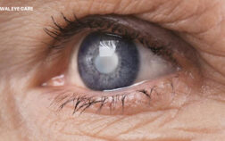 cataract eye surgery cost in mumbai - oswal eye care