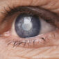 cataract eye surgery cost in mumbai - oswal eye care
