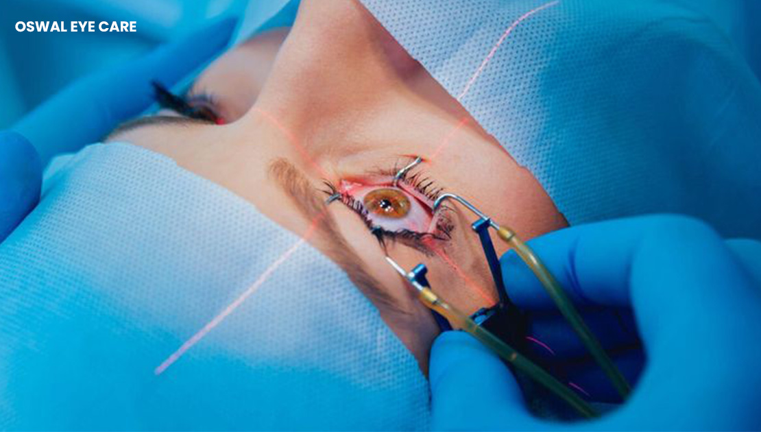 best cataract surgery in mumbai - oswal eye care