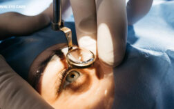 best doctor for cataract surgery in mumbai - oswal eye care