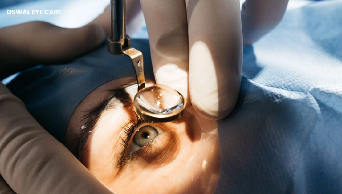 best doctor for cataract surgery in mumbai - oswal eye care